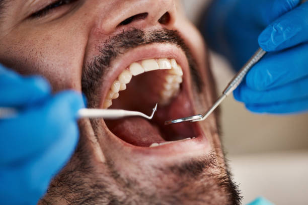 Best Cracked Tooth Emergency Dentist  in East Lansing, MI